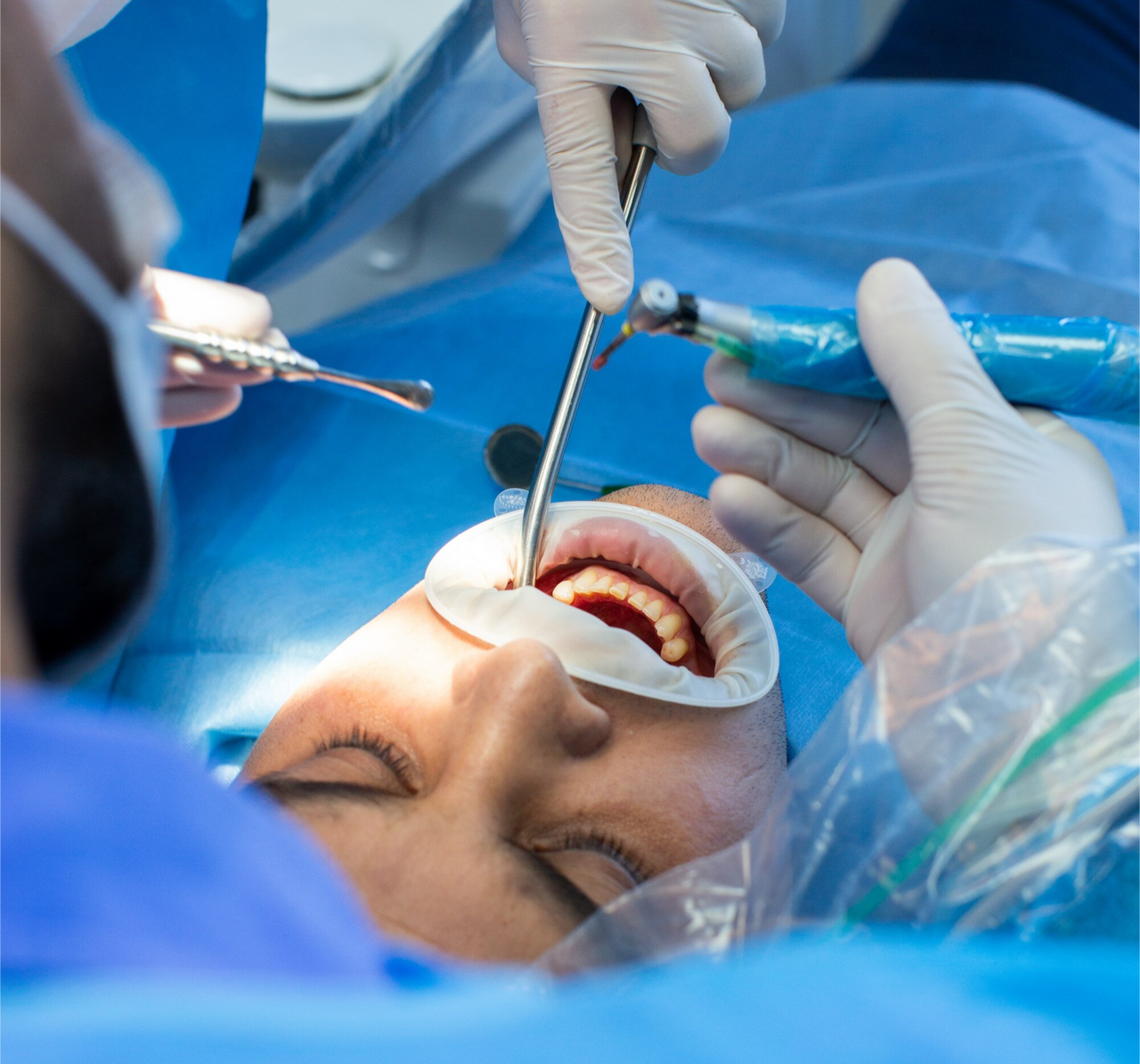 Paciente en procedimiento dental complejo realizado por odontólogos con herramientas especializadas.